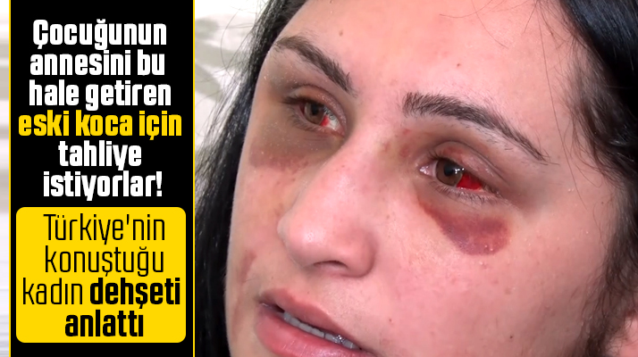 Samsun'da öldüresiye darp edilen kadın evinde açıklamalarda bulundu
