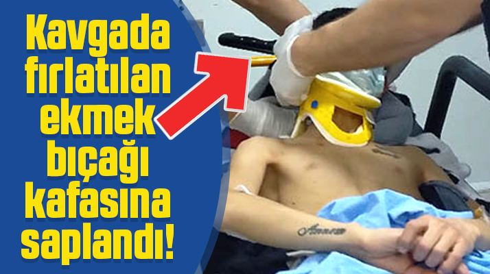 Samsun'da çıkan sokak kavgasında kafasına bıçak saplandı