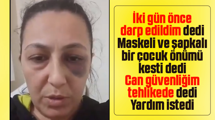 Samsun'da Emine Arslan isimli kadın şiddete maruz kaldığını söyledi yardım istedi
