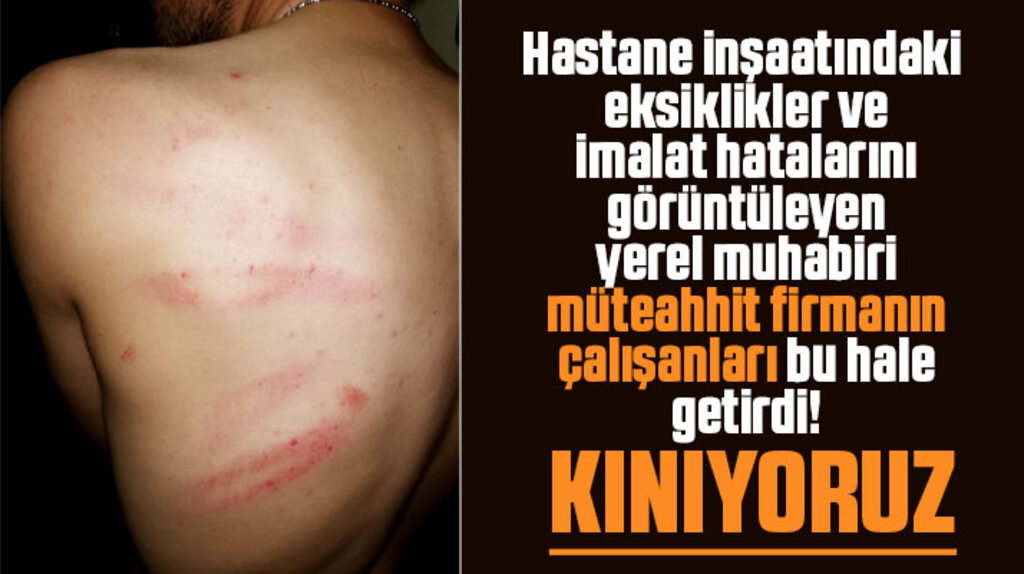 Samsun'un 19 Mayıs İlçesinde saldırıya uğrayan İbrahim Akkuş yara bere içinde kaldı