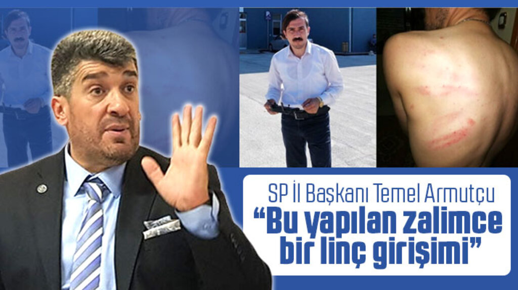 SP Samsun İl Başkanı Armutçu, gazeteci İbrahim Akkuş'a yapılan saldırıya tepki gösterdi