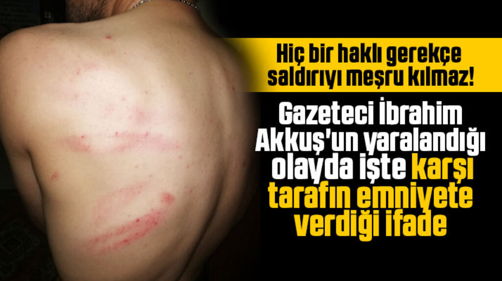 Samsun'da gazeteci İbrahim Akkuş'a saldıran kişinin emniyete verdiği ifade