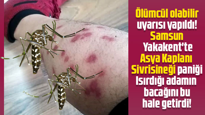 Samsun'un Yakakent İlçesinde Asya Kaplanı Sivrisineği paniği!