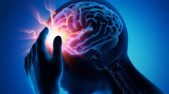 Beyin anevrizması belirtileri nelerdir? Uzman doktor ölümcül belirtileri açıkladı