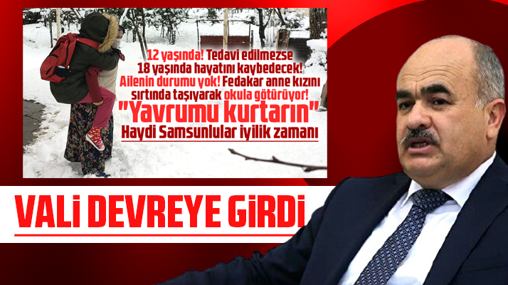 Samsun'da DMD hastası kızı için yardım isteyen annenin çığlığını Vali duydu!