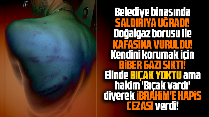 Samsun'da darp edilen muhabir İbrahim Akkuş'a hapis cezası kararı şoke etti