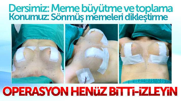 Estetik cerrah Hayati Akbaş, meme büyütme dikleştirme videosu yayınladı