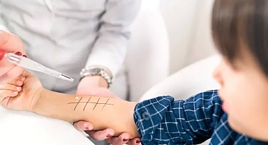 Alerjik hastalıklarda Deri Prick testi nedir?