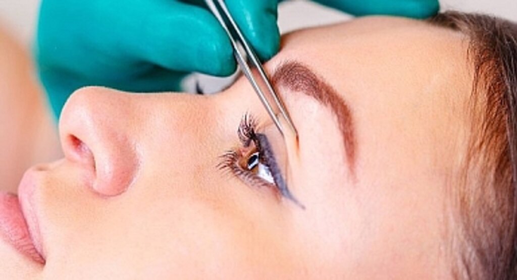 Göz kapağı estetiği nasıl yapılır? Blefaroplasti nedir?