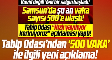Samsun'da kızamık salgını mı var? 500 vaka ile ilgili yeni açıklama!