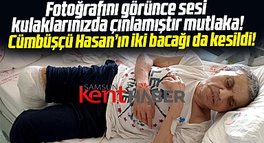 Samsun'da Cümbüşçü Hasan'ın son hali görenleri üzdü! İki bacağı da kesildi