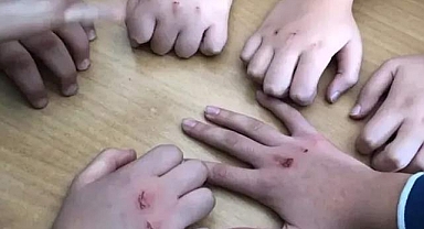 Kanlı para oyunu nedir! Çocuklarınız ellerinde yaralar varsa dikkat!