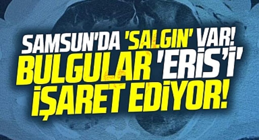 Samsun'da salgın var! Bulgular Eris varyantını işaret ediyor!