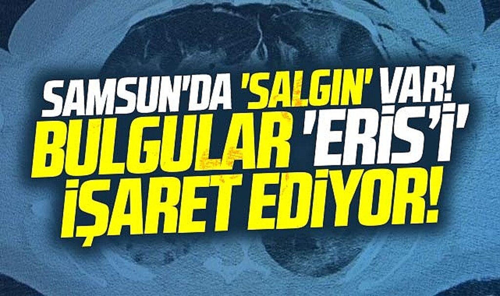 Samsun'da salgın var! Bulgular Eris varyantını işaret ediyor!