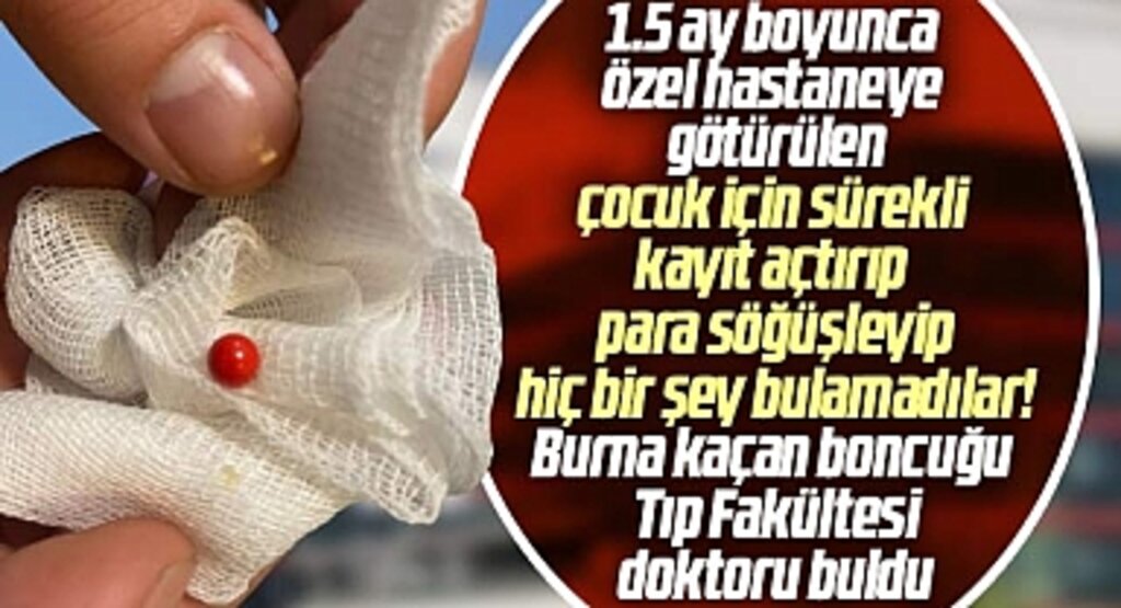 Samsun'da özel hastane doktoru ha bire kayıt açtırdı ama burna kaçan boncuğu bulamadı