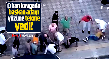 Samsun'da CHP'nin Atakum başkan adayı çıkan kavgada yüzüne tekme yedi