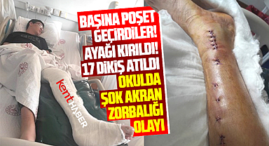 Samsun Final Okullarında şok akran zorbalığı! Öğrencinin ayağı kırıldı!