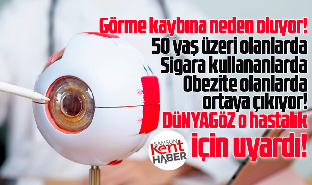 Dünyagöz'den 50 yaş üzeri ve sigara kullananlara sarı nokta uyarısı!