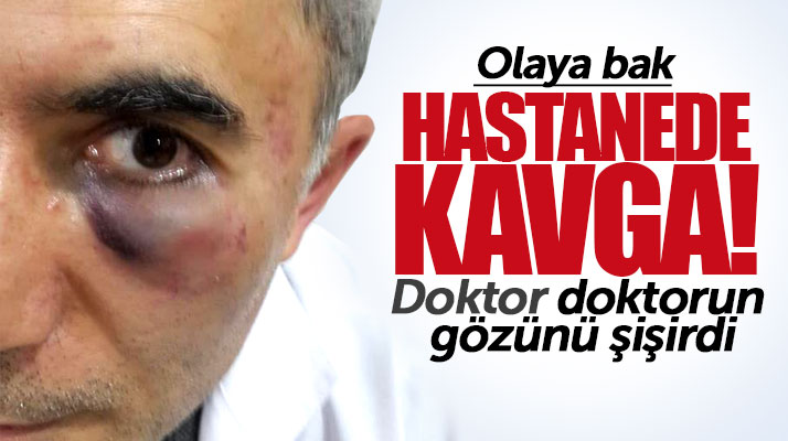 Samsun Bafra'da özel hastanede şok kavga! Doktor doktoru dövdü gözünü şişirdi