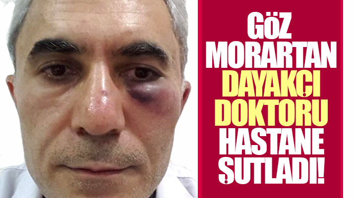 Samsun Bafra'da doktoru darp edip gözünü morartan o doktorun işine son verildi
