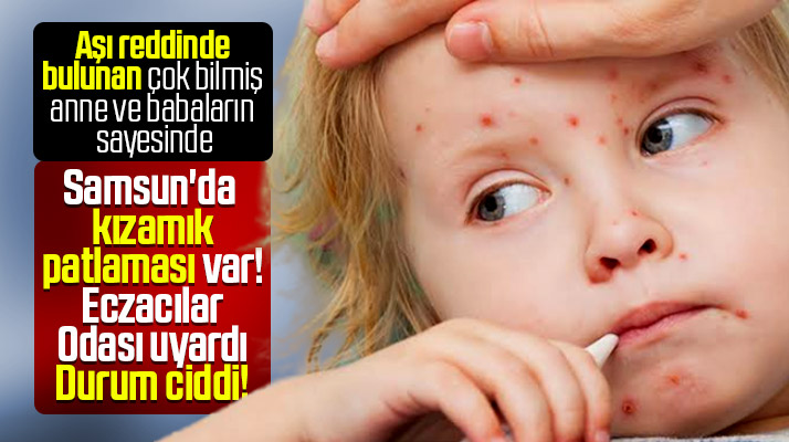 Samsun Eczacı Odası uyardı! Aşı reddi yüzünden kızamık hastalığında artış var